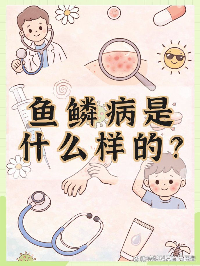 魚鱗病有哪些類型，@皮膚科夏育民醫(yī)生怎么判斷魚鱗病是什么樣的魚鱗病 魚鱗病有哪些類型，@皮膚科夏育民醫(yī)生怎么判斷魚鱗病是什么樣的魚鱗病 龍魚百科 第1張