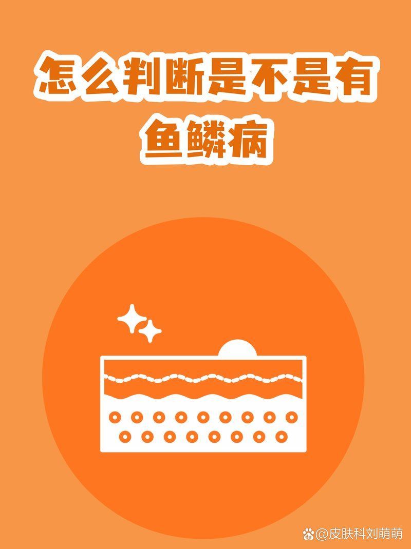 魚鱗病有哪些類型，@皮膚科夏育民醫(yī)生怎么判斷魚鱗病是什么樣的魚鱗病 魚鱗病有哪些類型，@皮膚科夏育民醫(yī)生怎么判斷魚鱗病是什么樣的魚鱗病 龍魚百科 第2張