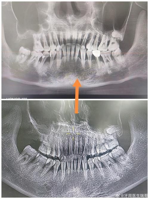 xlyc圖片5張2有哪些識別特征？，xlyc圖片5張2有哪些識別特征 xlyc圖片5張2有哪些識別特征？，xlyc圖片5張2有哪些識別特征 龍魚百科 第9張