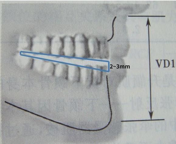 xlyc圖片5張2有哪些識別特征？，xlyc圖片5張2有哪些識別特征 xlyc圖片5張2有哪些識別特征？，xlyc圖片5張2有哪些識別特征 龍魚百科 第12張