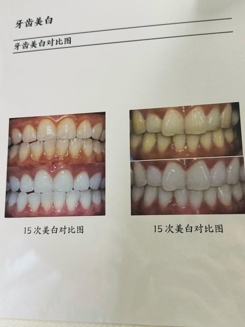 xlyc圖片5張2有哪些識別特征？，xlyc圖片5張2有哪些識別特征 xlyc圖片5張2有哪些識別特征？，xlyc圖片5張2有哪些識別特征 龍魚百科 第11張