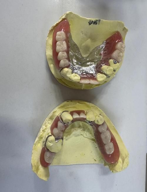 xlyc圖片5張2有哪些識別特征？，xlyc圖片5張2有哪些識別特征 xlyc圖片5張2有哪些識別特征？，xlyc圖片5張2有哪些識別特征 龍魚百科 第2張