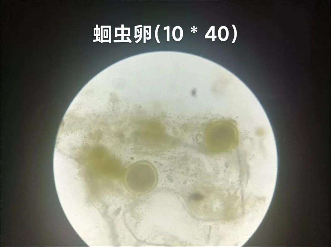 恐龍王魚有哪些常見疾病,恐龍王魚寄生蟲防治 龍魚百科 第5張 恐龍王魚有哪些常見疾病,恐龍王魚寄生蟲防治 恐龍王魚有哪些常見疾病,恐龍王魚寄生蟲防治 龍魚百科 第5張