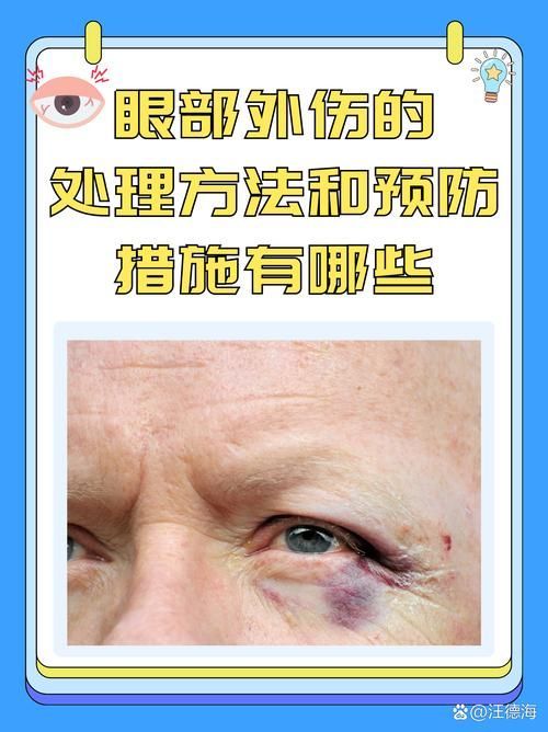 黃粉治療蒙眼病有哪些副作用，黃粉治療“蒙眼病” 黃粉治療蒙眼病有哪些副作用，黃粉治療“蒙眼病” 龍魚百科 第4張