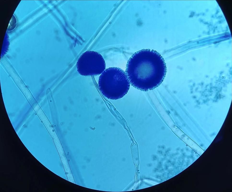 黃粉治療黑霉有哪些副作用，黃粉治療黑霉有哪些副作用調用工具 黃粉治療黑霉有哪些副作用，黃粉治療黑霉有哪些副作用調用工具 龍魚百科 第1張
