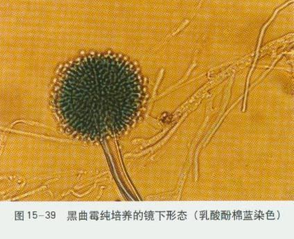 黃粉治療黑霉有哪些副作用，黃粉治療黑霉有哪些副作用調用工具 黃粉治療黑霉有哪些副作用，黃粉治療黑霉有哪些副作用調用工具 龍魚百科 第4張