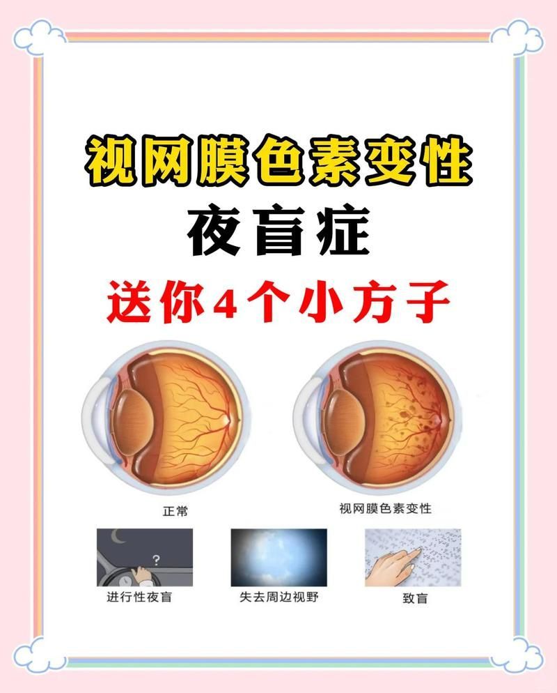 有哪些方法可以改善夜盲癥，夜盲癥如何改善 有哪些方法可以改善夜盲癥，夜盲癥如何改善 龍魚百科 第1張