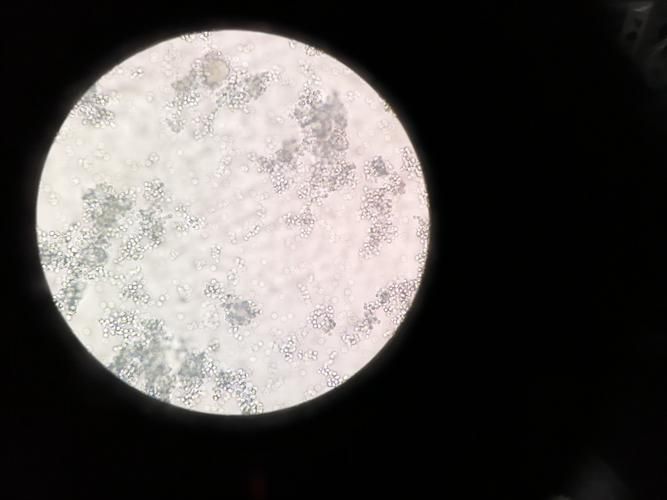 亞甲基藍(lán)治療真菌病需要多久見效，亞甲基藍(lán)（methyleneblue）在人類真菌病治療中的應(yīng)用
