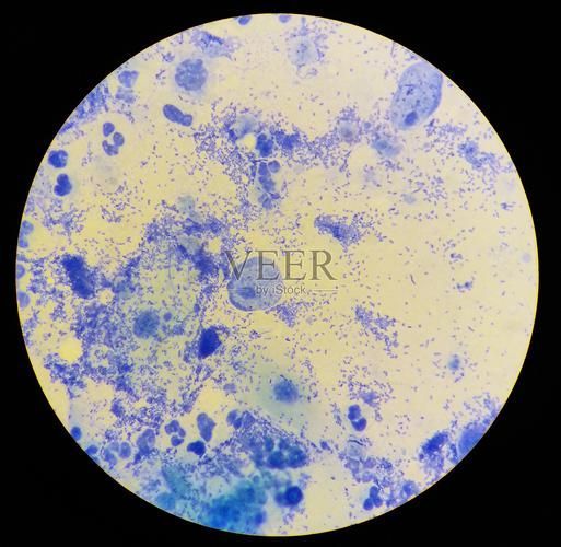 亞甲基藍(lán)治療真菌病需要多久見(jiàn)效，亞甲基藍(lán)（methyleneblue）在人類真菌病治療中的應(yīng)用 亞甲基藍(lán)治療真菌病需要多久見(jiàn)效，亞甲基藍(lán)（methyleneblue）在人類真菌病治療中的應(yīng)用 龍魚(yú)百科 第3張