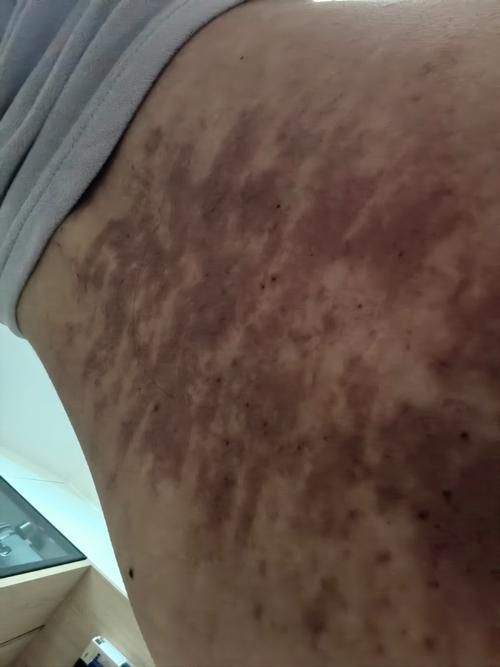 如何辨別馬來西亞BD魟魚的品相？，如何詳解1000字+配圖 如何辨別馬來西亞BD魟魚的品相？，如何詳解1000字+配圖 龍魚百科 第4張