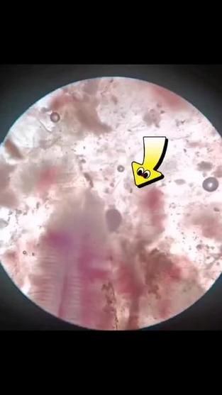 如何判斷龍魚腮上小氣泡是否為氣泡病?,如何判斷龍魚腮上小氣泡是否為氣泡病 龍魚百科 第4張 如何判斷龍魚腮上小氣泡是否為氣泡病?,如何判斷龍魚腮上小氣泡是否為氣泡病 如何判斷龍魚腮上小氣泡是否為氣泡病?,如何判斷龍魚腮上小氣泡是否為氣泡病 龍魚百科 第4張