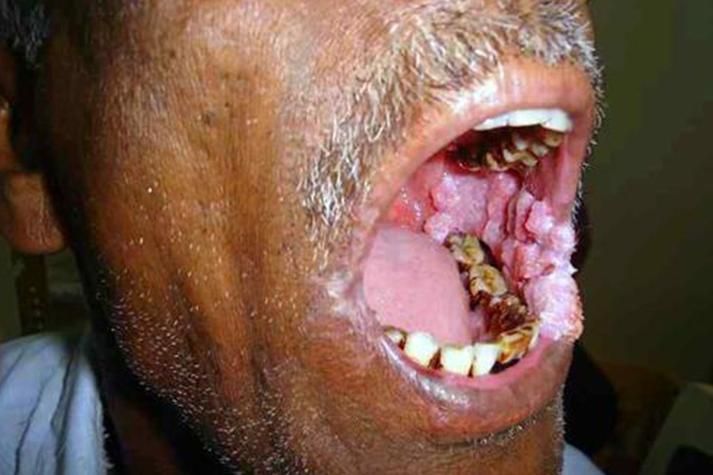 如何區分龍魚嘴巴的良性與惡性腫瘤？，如何區分龍魚嘴巴的良性與惡性腫瘤并明確要求1000字說明和配圖 如何區分龍魚嘴巴的良性與惡性腫瘤？，如何區分龍魚嘴巴的良性與惡性腫瘤并明確要求1000字說明和配圖 龍魚百科 第5張
