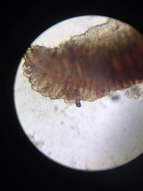 紅龍魚寄生蟲感染如何防治？，紅龍魚寄生蟲感染的防治方法分享石師傅影綜紀實錄展開 紅龍魚寄生蟲感染如何防治？，紅龍魚寄生蟲感染的防治方法分享石師傅影綜紀實錄展開 龍魚百科 第5張
