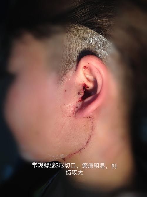龍魚鰓上長包手術風險大嗎？，專業(yè)機構可以治療龍魚大部分病變嗎？ 龍魚鰓上長包手術風險大嗎？，專業(yè)機構可以治療龍魚大部分病變嗎？ 龍魚百科 第5張