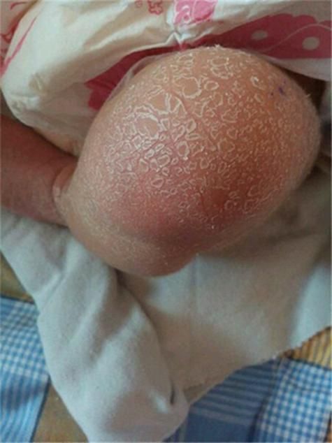 有哪些藥物可以治療松鱗病,魚鱗病外用藥物搭配 龍魚百科 第3張 有哪些藥物可以治療松鱗病,魚鱗病外用藥物搭配 有哪些藥物可以治療松鱗病,魚鱗病外用藥物搭配 龍魚百科 第3張