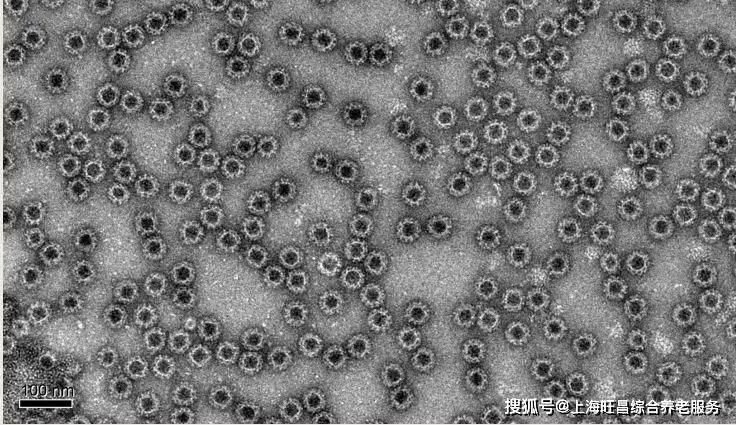 西安地區(qū)春季腸炎高發(fā)原因 西安地區(qū)春季腸炎高發(fā)原因 龍魚(yú)百科 第8張