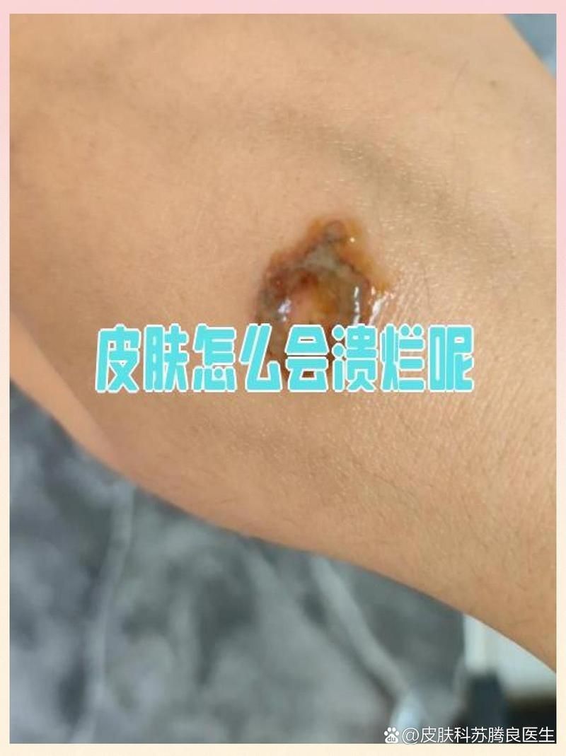 病毒性爛身病如何防控，如何防控病毒性爛身病 病毒性爛身病如何防控，如何防控病毒性爛身病 龍魚百科 第1張