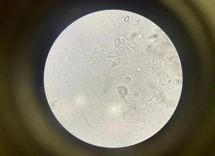 黃鰭鯧魚寄生蟲病如何治療？，黃鰭鯧魚如何治療寄生蟲病 黃鰭鯧魚寄生蟲病如何治療？，黃鰭鯧魚如何治療寄生蟲病 龍魚百科 第6張