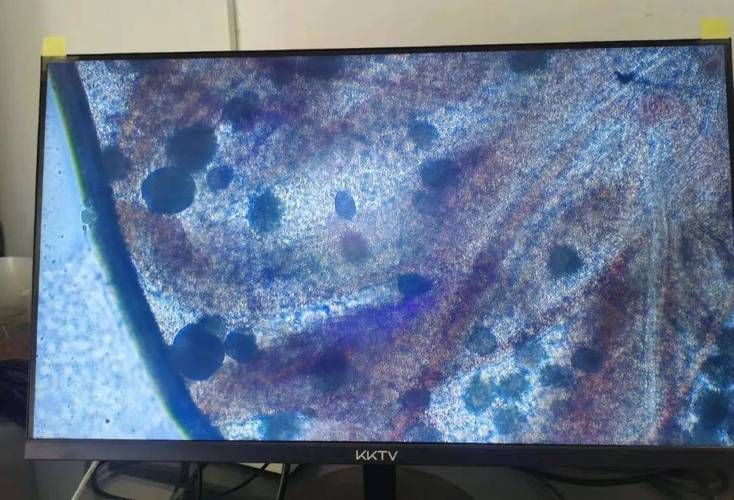 黃鰭鯧魚寄生蟲病如何治療？，黃鰭鯧魚如何治療寄生蟲病 黃鰭鯧魚寄生蟲病如何治療？，黃鰭鯧魚如何治療寄生蟲病 龍魚百科 第1張
