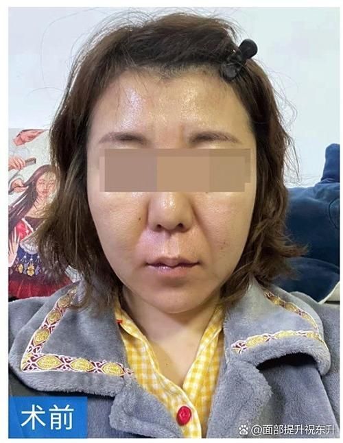 炸鱗病自愈后需要多久恢復(fù)活力，炸鱗病自愈后恢復(fù)活力共調(diào)用2個(gè)工具、鱗片再生過程圖文詳解 炸鱗病自愈后需要多久恢復(fù)活力，炸鱗病自愈后恢復(fù)活力共調(diào)用2個(gè)工具、鱗片再生過程圖文詳解 龍魚百科 第6張