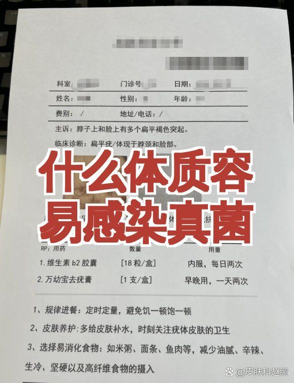 哪些人群更容易患真菌感染，哪些人容易患真菌感染？ 哪些人群更容易患真菌感染，哪些人容易患真菌感染？ 龍魚百科 第1張