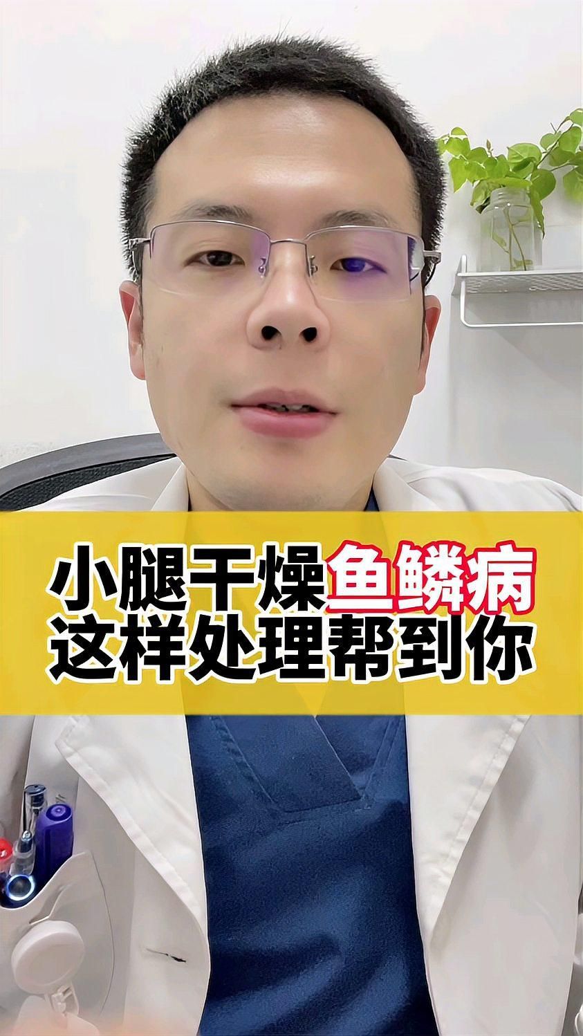 魚鱗病的癥狀有哪些，魚鱗病的主要癥狀有哪些