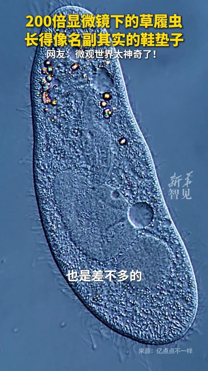 如何區分面包蟲殘骸和真正寄生蟲，面包蟲殘骸和寄生蟲的區分主要基于形態學特征、生活史和寄生方式