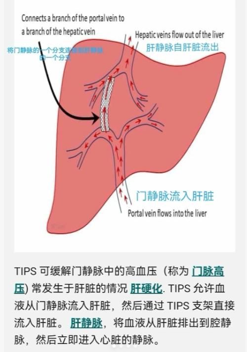 腹水病如何治療，干預腹水病治療 腹水病如何治療，干預腹水病治療 龍魚百科 第4張