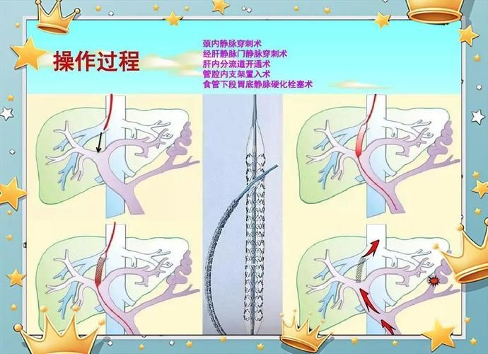 腹水病如何治療，干預腹水病治療 腹水病如何治療，干預腹水病治療 龍魚百科 第1張