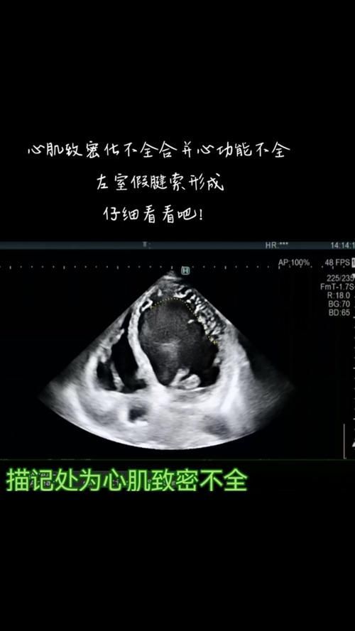 能否給出更多診斷案例，三甲醫院醫療診斷案例“1000字和配圖）能否給出更多診斷案例 能否給出更多診斷案例，三甲醫院醫療診斷案例“1000字和配圖）能否給出更多診斷案例 龍魚百科 第8張