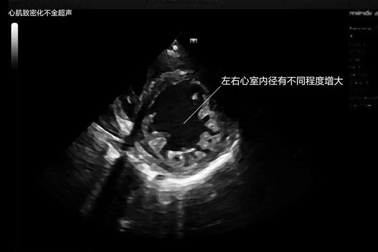能否給出更多診斷案例，三甲醫院醫療診斷案例“1000字和配圖）能否給出更多診斷案例 能否給出更多診斷案例，三甲醫院醫療診斷案例“1000字和配圖）能否給出更多診斷案例 龍魚百科 第7張