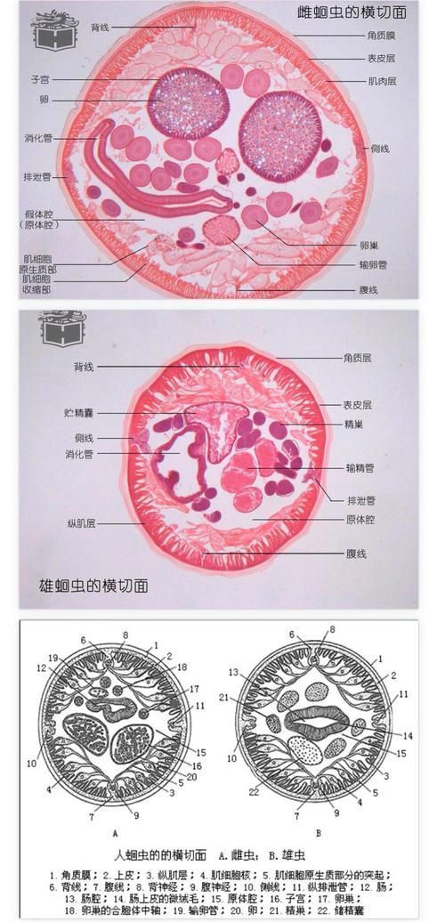 如何預防龍魚內寄感染，如何預防龍魚內寄感染思考完成1000字+配圖指南 如何預防龍魚內寄感染，如何預防龍魚內寄感染思考完成1000字+配圖指南 龍魚百科 第6張