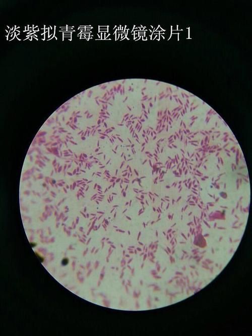 有哪些生物可以控制白色線蟲，富媒體組件庫中雖有多個(gè)“白色線蟲”主動(dòng)召回專業(yè)圖像資源