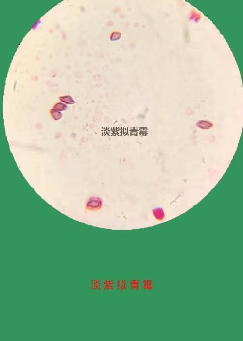 有哪些生物可以控制白色線蟲，富媒體組件庫中雖有多個“白色線蟲”主動召回專業圖像資源