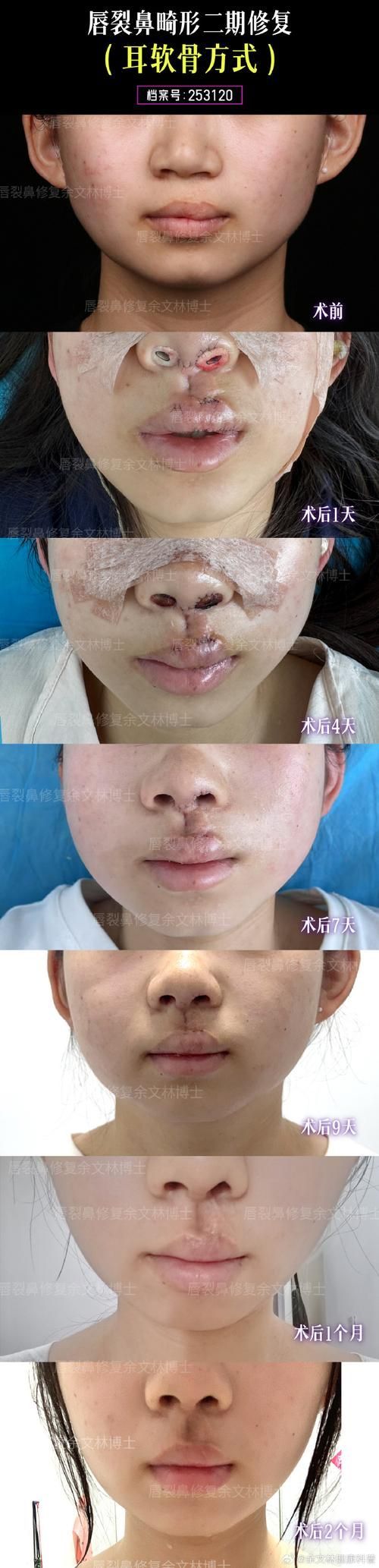 如何判斷龍魚是否需要手術磨骨？，如何判斷“龍魚是否需要手術磨骨”