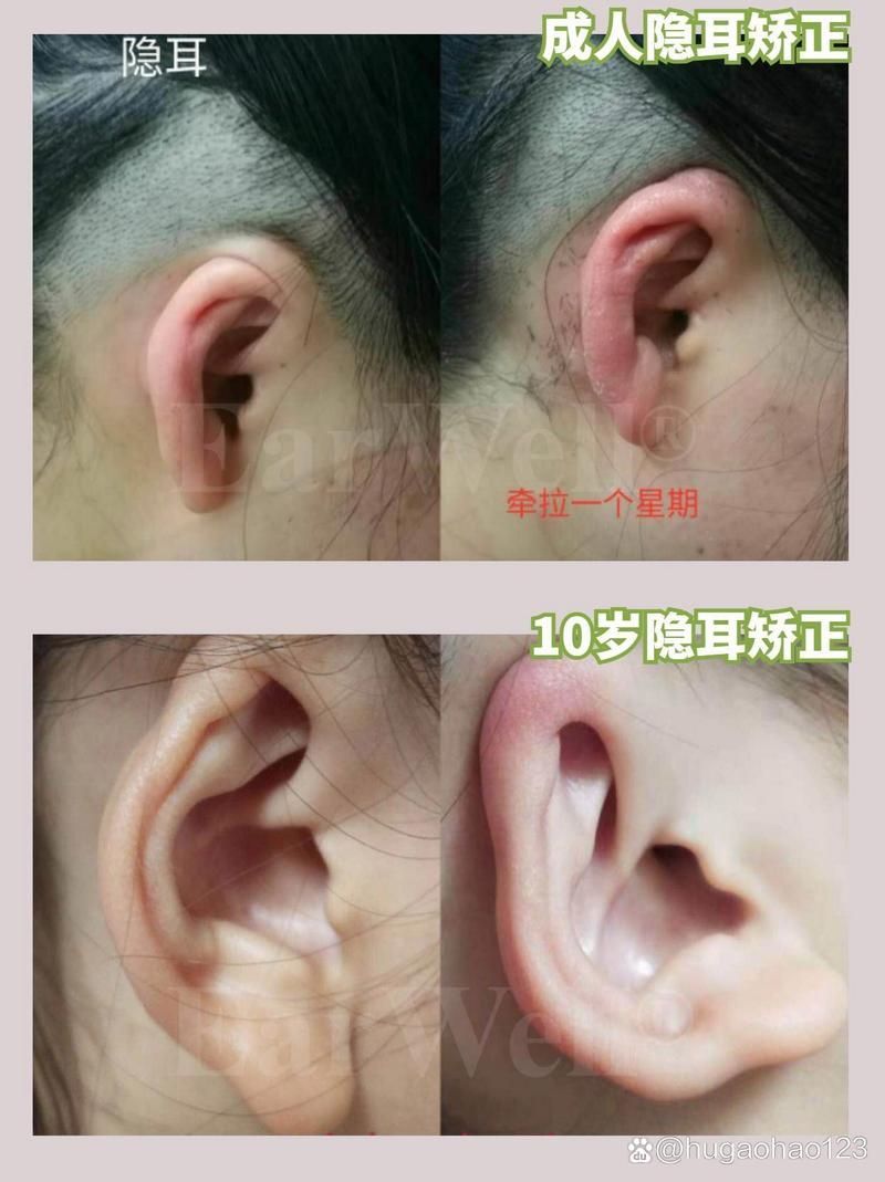如何判斷龍魚是否需要手術磨骨？，如何判斷“龍魚是否需要手術磨骨”