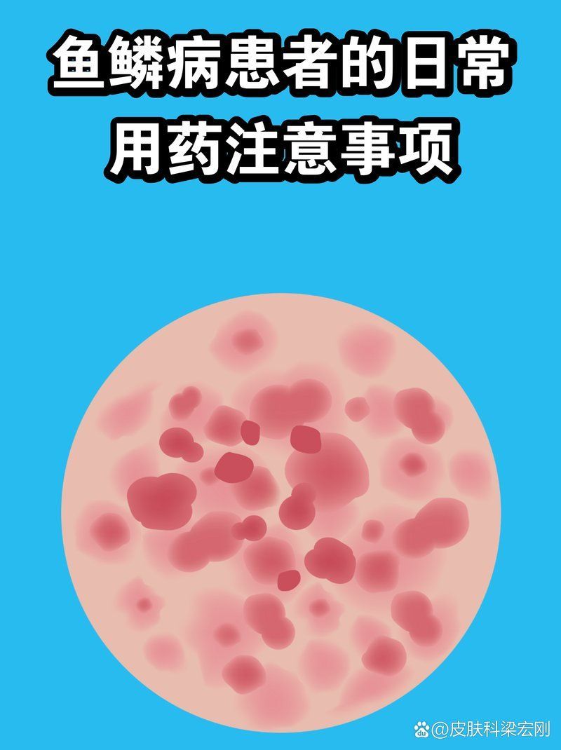 如何正確使用魚鱗病藥物，關于魚鱗病的一些問題