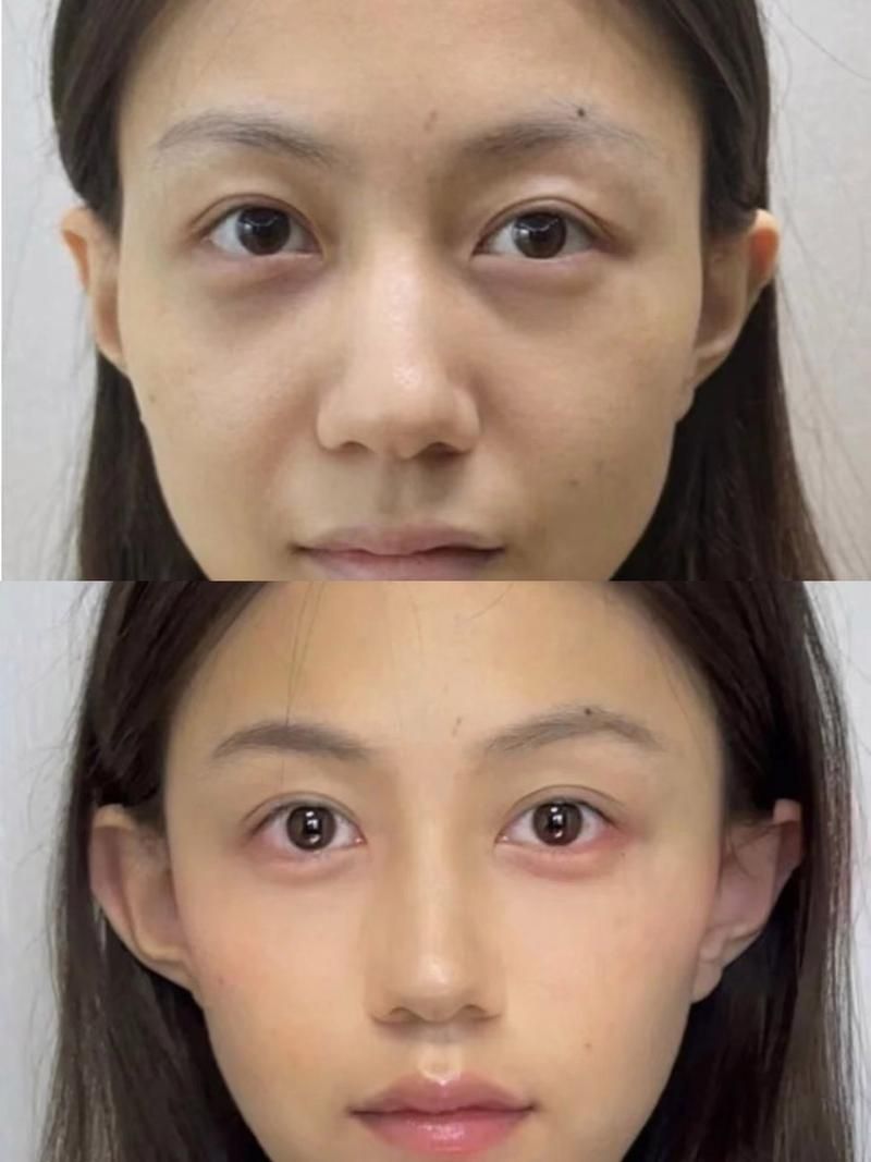能否提供更詳細(xì)的對(duì)比圖 能否提供更詳細(xì)的對(duì)比圖 龍魚(yú)百科 第6張