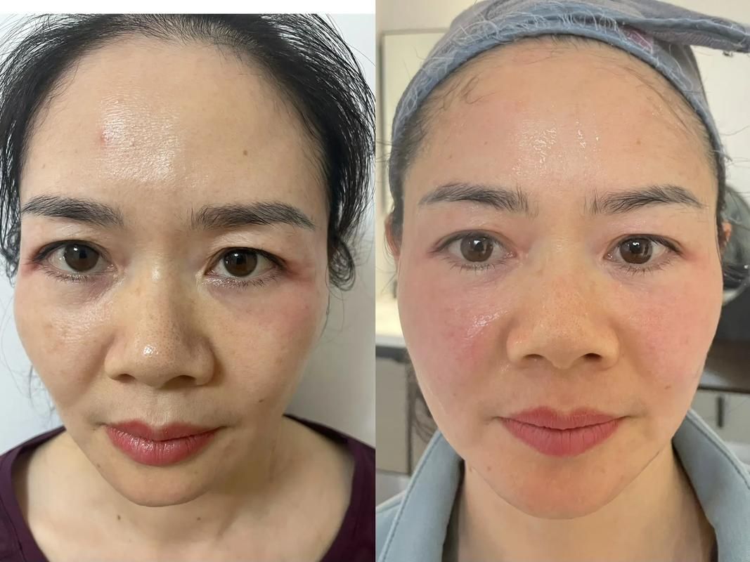 能否提供更詳細(xì)的對(duì)比圖 能否提供更詳細(xì)的對(duì)比圖 龍魚(yú)百科 第4張
