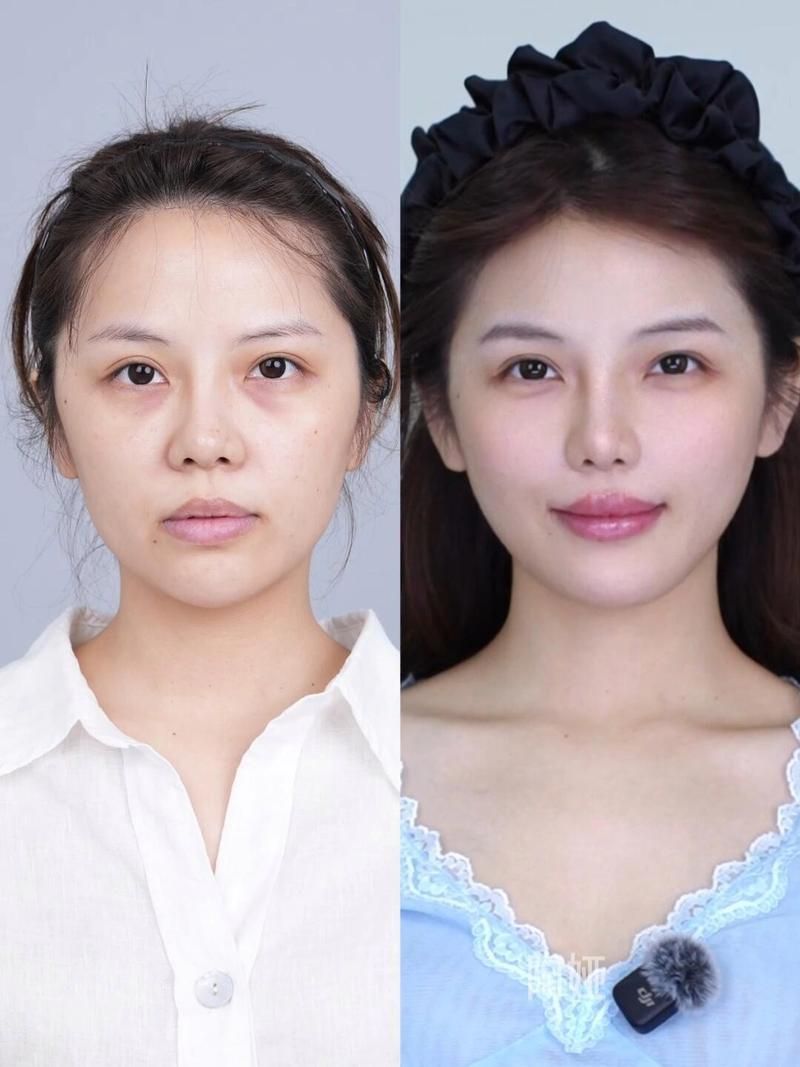 能否提供更詳細(xì)的對(duì)比圖 能否提供更詳細(xì)的對(duì)比圖 龍魚(yú)百科 第12張