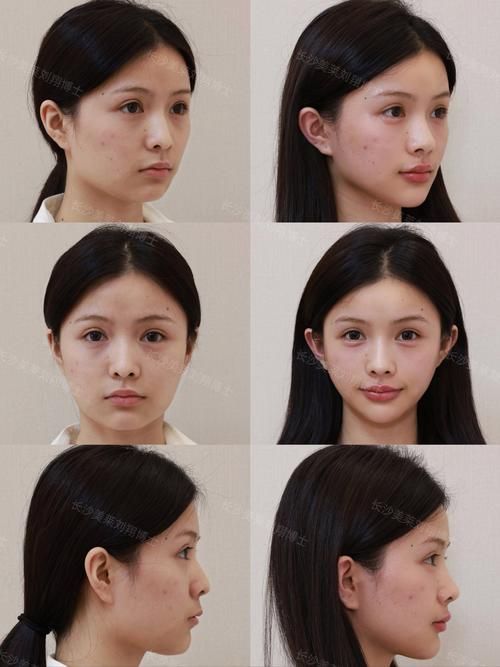 能否提供更詳細(xì)的對(duì)比圖 能否提供更詳細(xì)的對(duì)比圖 龍魚(yú)百科 第14張