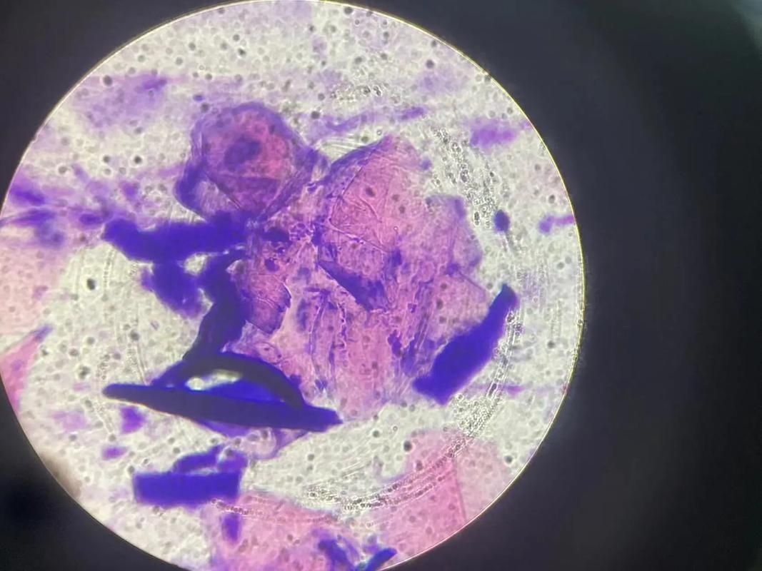 如何預防魚蒙眼病的傳染，exophthalmia預防魚蒙眼病（exophthalmia）預防技術詳解 如何預防魚蒙眼病的傳染，exophthalmia預防魚蒙眼病（exophthalmia）預防技術詳解 龍魚百科 第5張