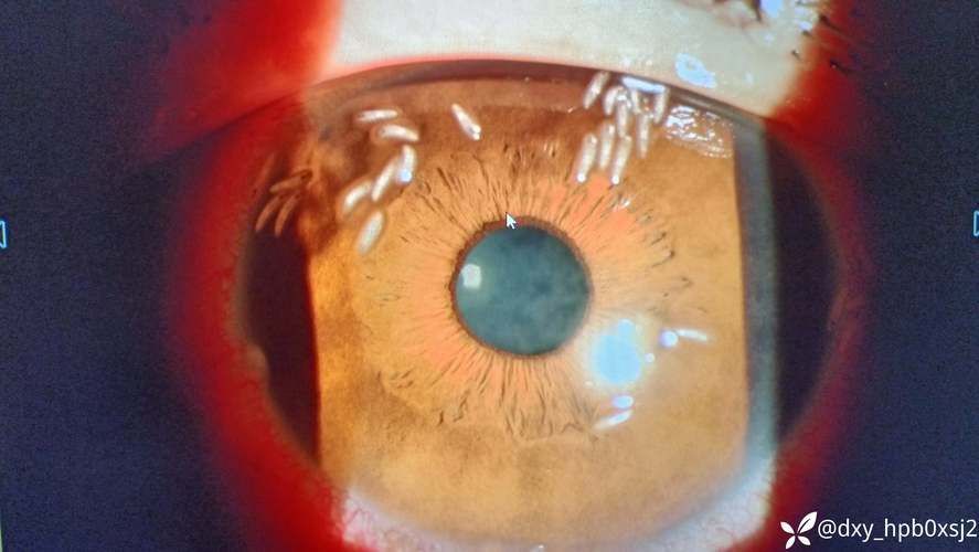 如何預防魚蒙眼病的傳染，exophthalmia預防魚蒙眼病（exophthalmia）預防技術詳解 如何預防魚蒙眼病的傳染，exophthalmia預防魚蒙眼病（exophthalmia）預防技術詳解 龍魚百科 第3張