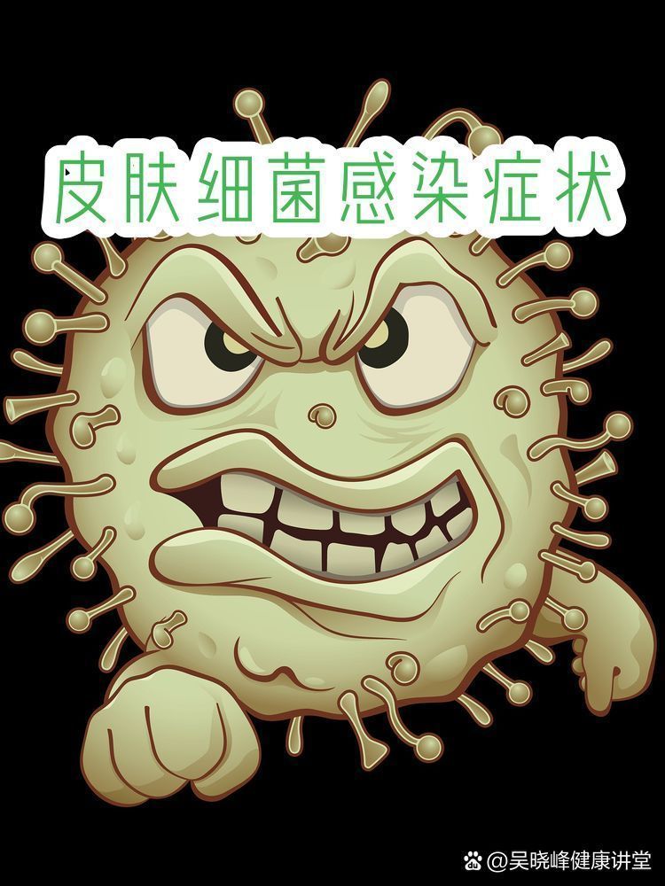 如何區分細菌性和病毒性爛身，如何區分細菌性和病毒性“爛身” 如何區分細菌性和病毒性爛身，如何區分細菌性和病毒性“爛身” 龍魚百科 第2張