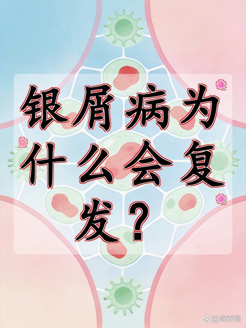 立鱗病復發率高嗎，權威醫學文獻與百度健康平臺的立鱗病復發率高嗎