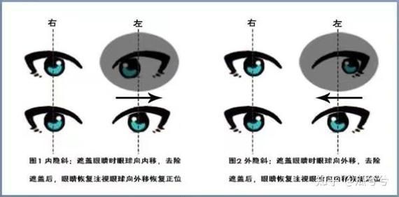 如何判斷蒙眼類型，富媒體組件庫中“蒙眼類型”在多個領域的定義與判斷標準