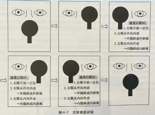 如何判斷蒙眼類型，富媒體組件庫中“蒙眼類型”在多個領域的定義與判斷標準