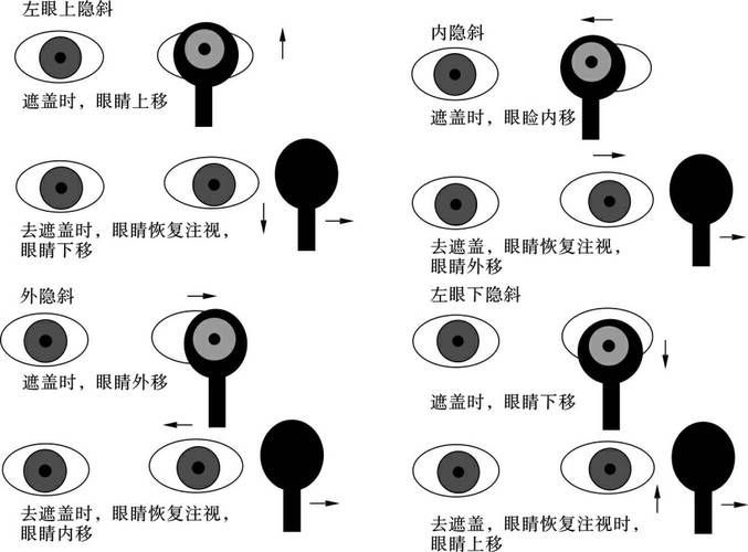 如何判斷蒙眼類型，富媒體組件庫中“蒙眼類型”在多個領域的定義與判斷標準