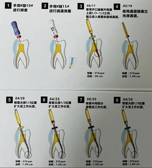 有沒有更詳細的治療步驟，****：治療步驟的治療步驟 有沒有更詳細的治療步驟，****：治療步驟的治療步驟 龍魚百科 第1張