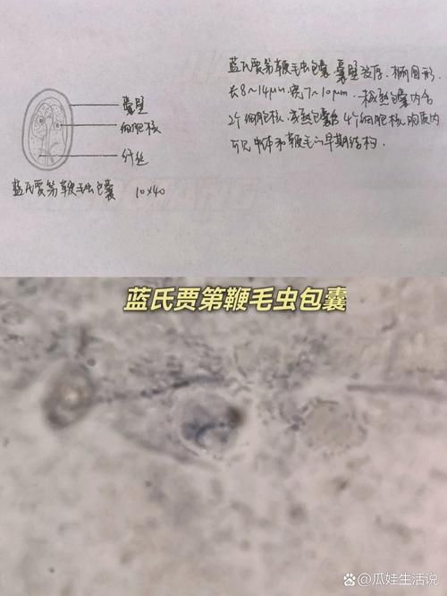 龍魚內寄生蟲有哪些常見種類，arxiv論文助手檢索是否有水產寄生蟲相關的最新研究 龍魚內寄生蟲有哪些常見種類，arxiv論文助手檢索是否有水產寄生蟲相關的最新研究 龍魚百科 第6張